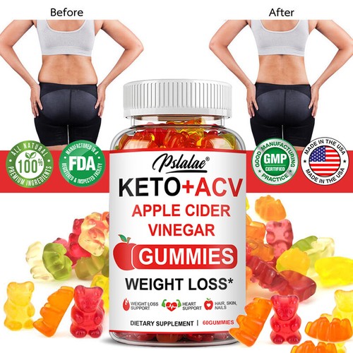 Keto acv gummies belly fat - gummies,